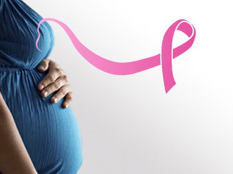 بارداری، شیردهی و سرطان پستان